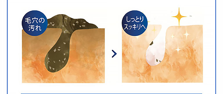 毛穴の汚れ しっとりスッキリへ